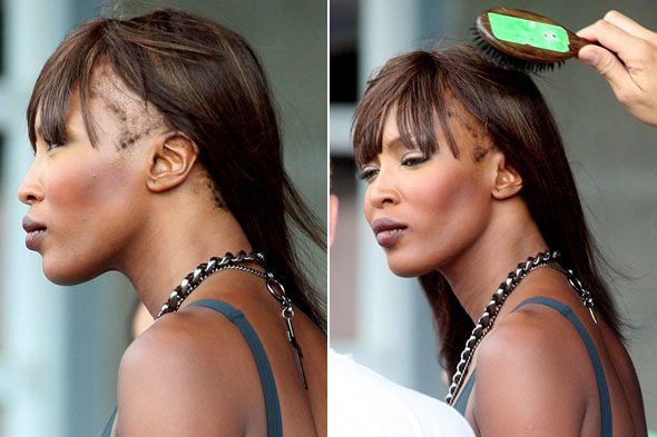 Naomi Campbell mengalami kebotakan karena rambut rontok